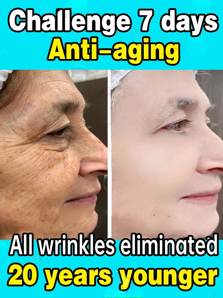 Effective anti-ageing and anti-wrinkle facial serum to remove facial wrinkles fine lines around the eyes crow's feet neck wrinkl
