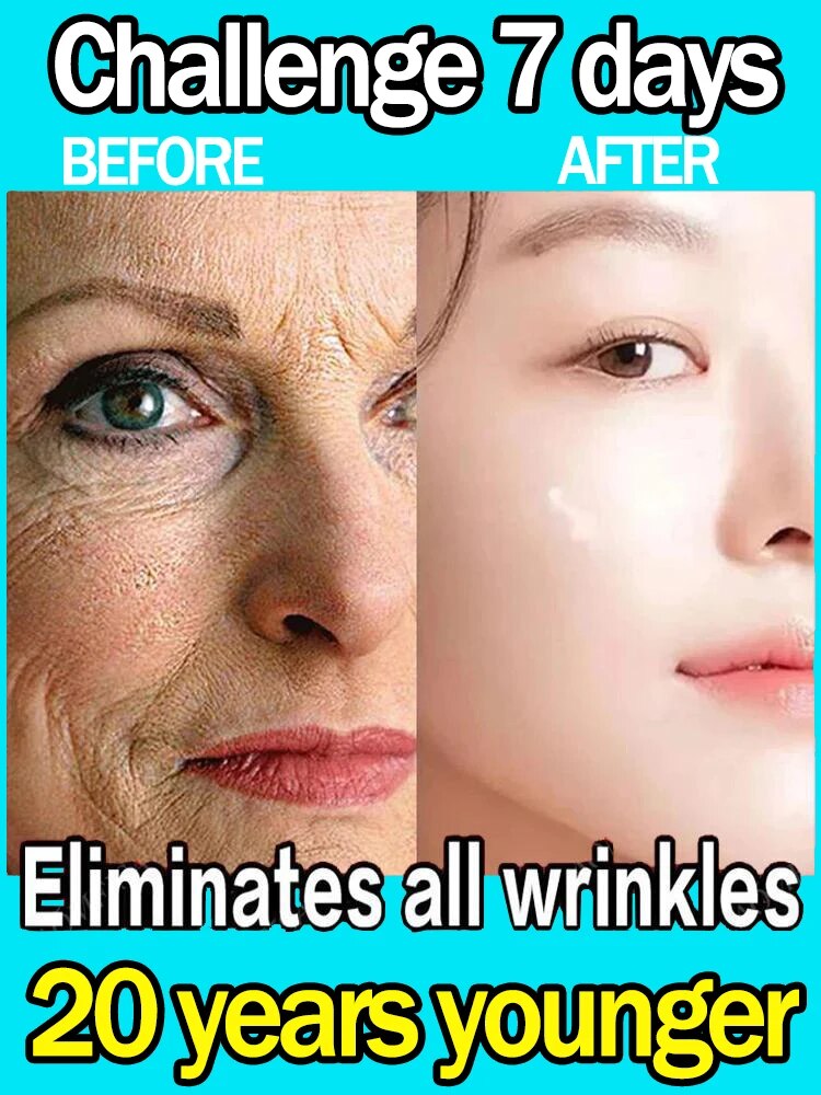 Effective anti-ageing and anti-wrinkle facial serum to remove facial wrinkles fine lines around the eyes crow's feet neck wrinkl